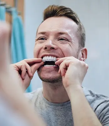 Man inserting clear aligner tray into mouth for invisible braces treatment.