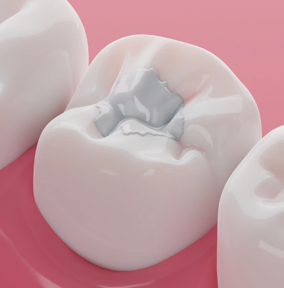 A More Natural Way to Restore Your Smile