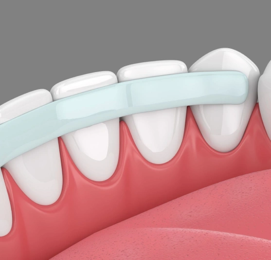 A Simple Way to Repair and Refresh Your Smile