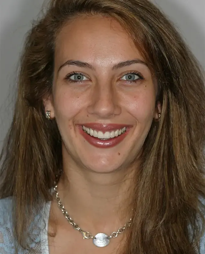 Smiling woman with bright white teeth showcasing a healthy dental smile in Mineola, NY.