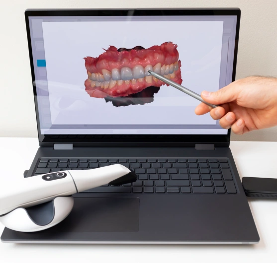 Intraoral Camera Technology for Clearer Diagnosis