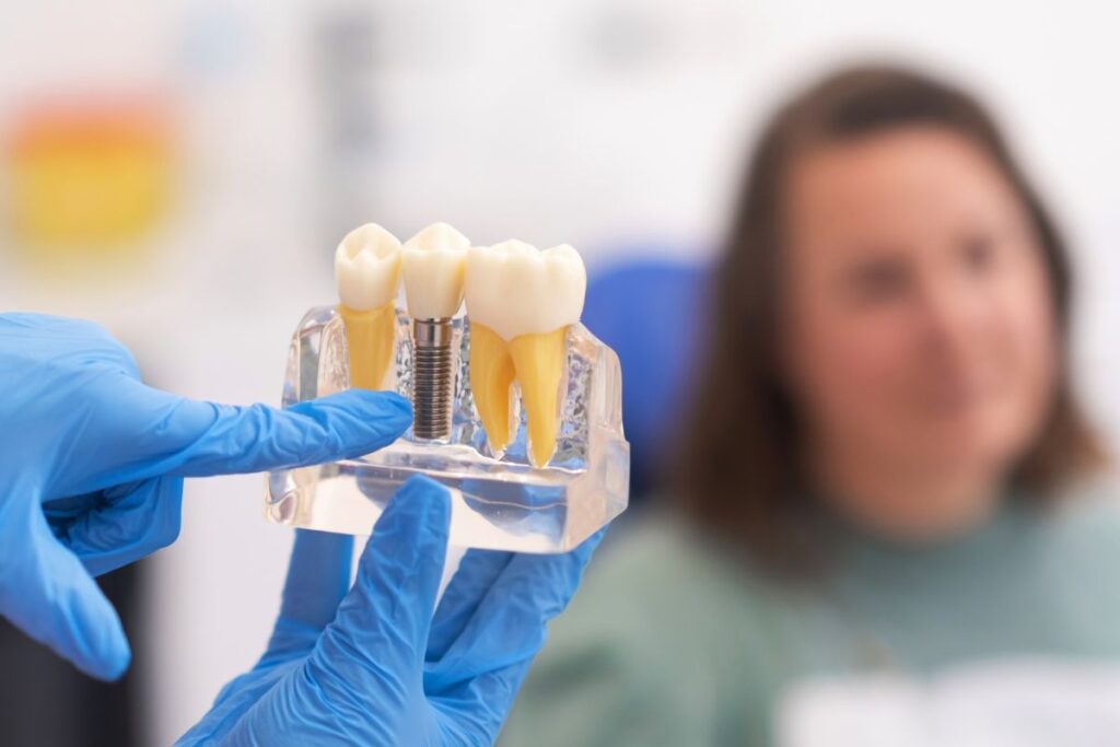 Dental implant model showing an implant-supported replacement tooth
