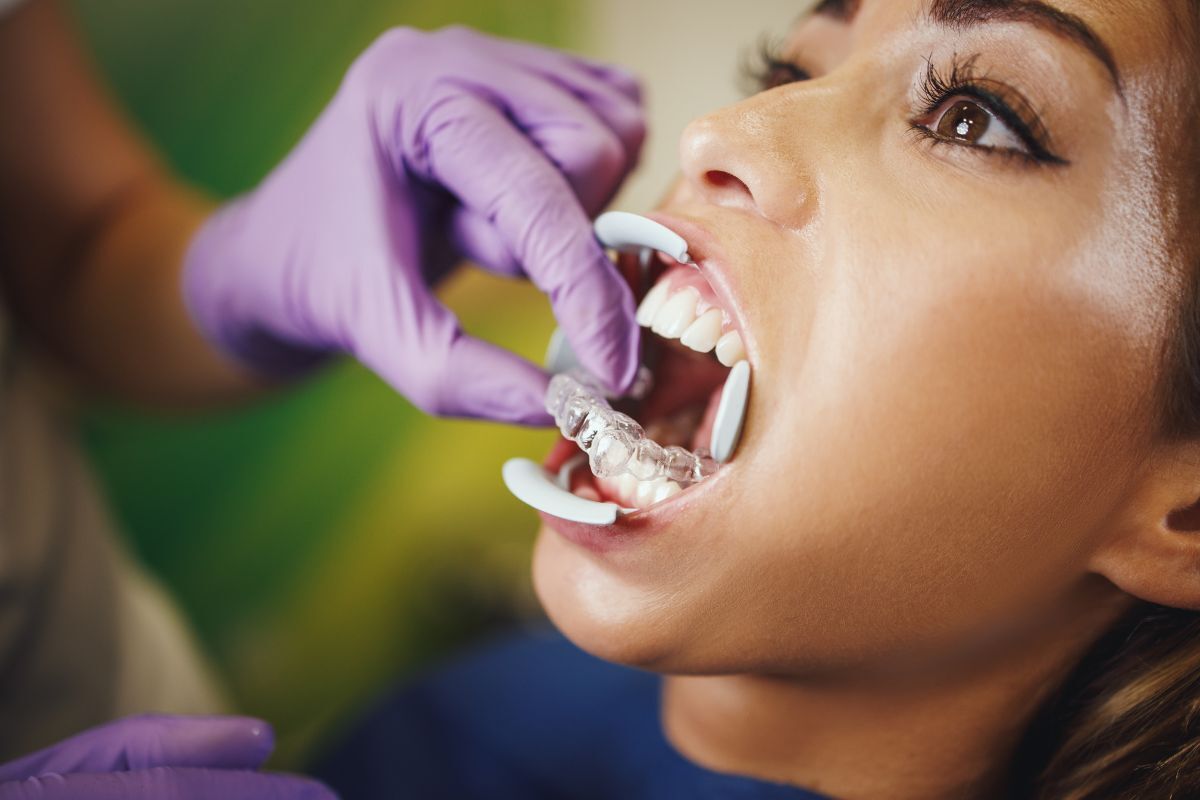 Patient receiving Invisalign treatment to correct black triangles between teeth at dental office.