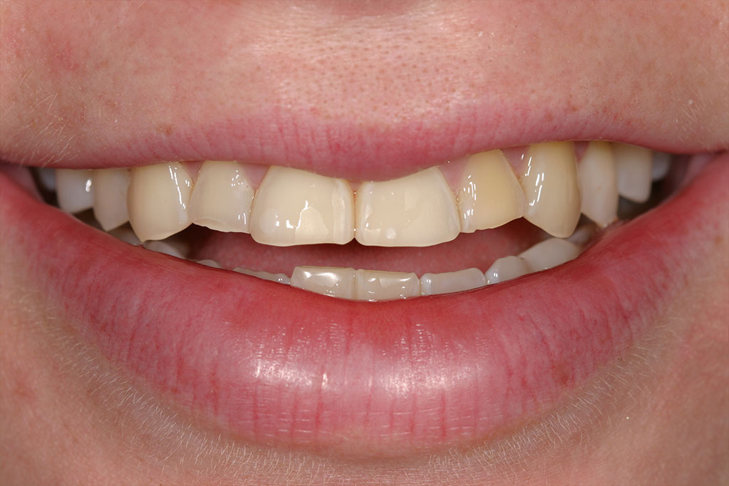 smile gallery photo