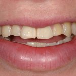 smile gallery photo