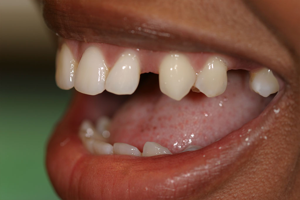 smile gallery photo