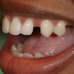 smile gallery photo