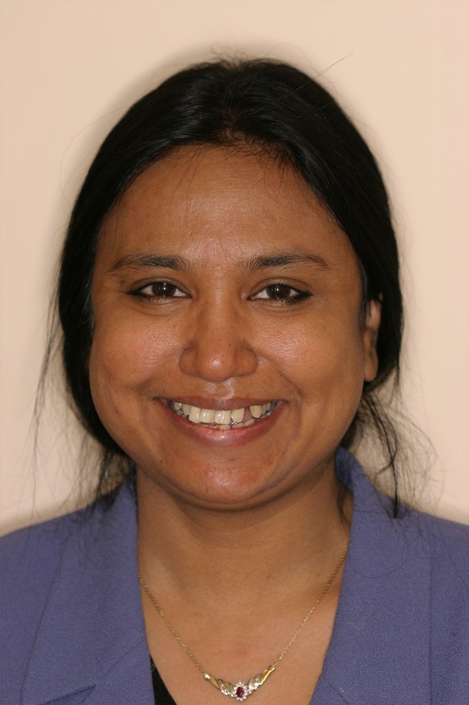 smile gallery photo