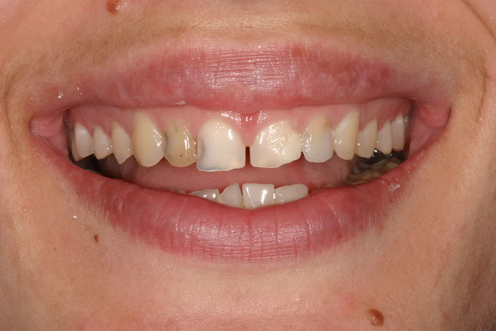 smile gallery photo