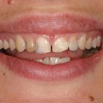 smile gallery photo