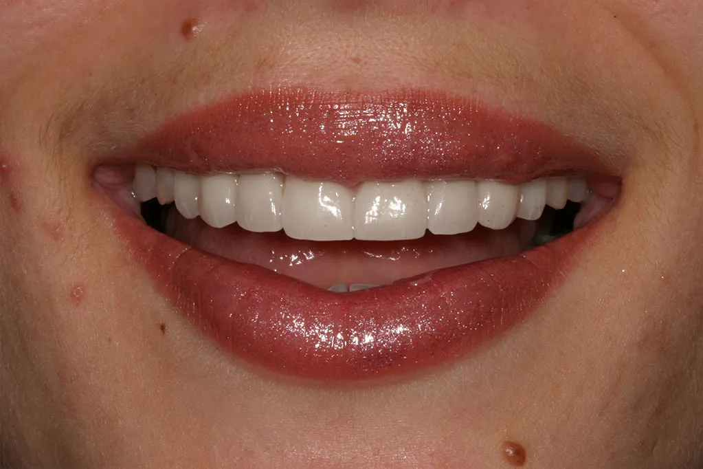 smile gallery photo