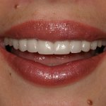 smile gallery photo