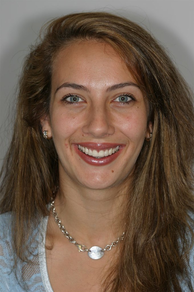 smile gallery photo