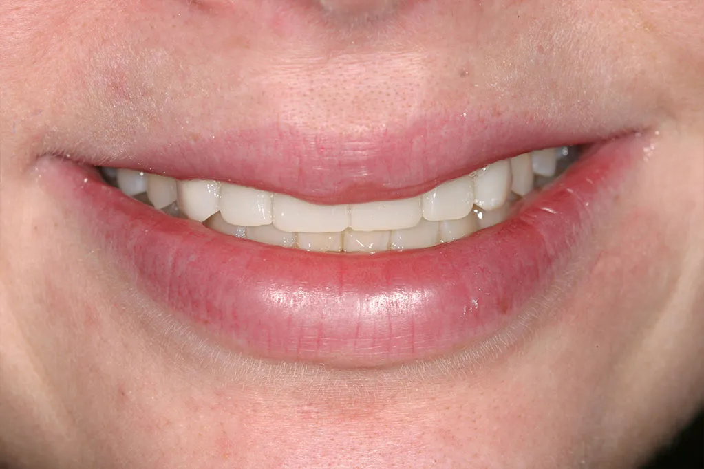 smile gallery photo
