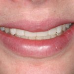 smile gallery photo