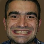 smile gallery photo