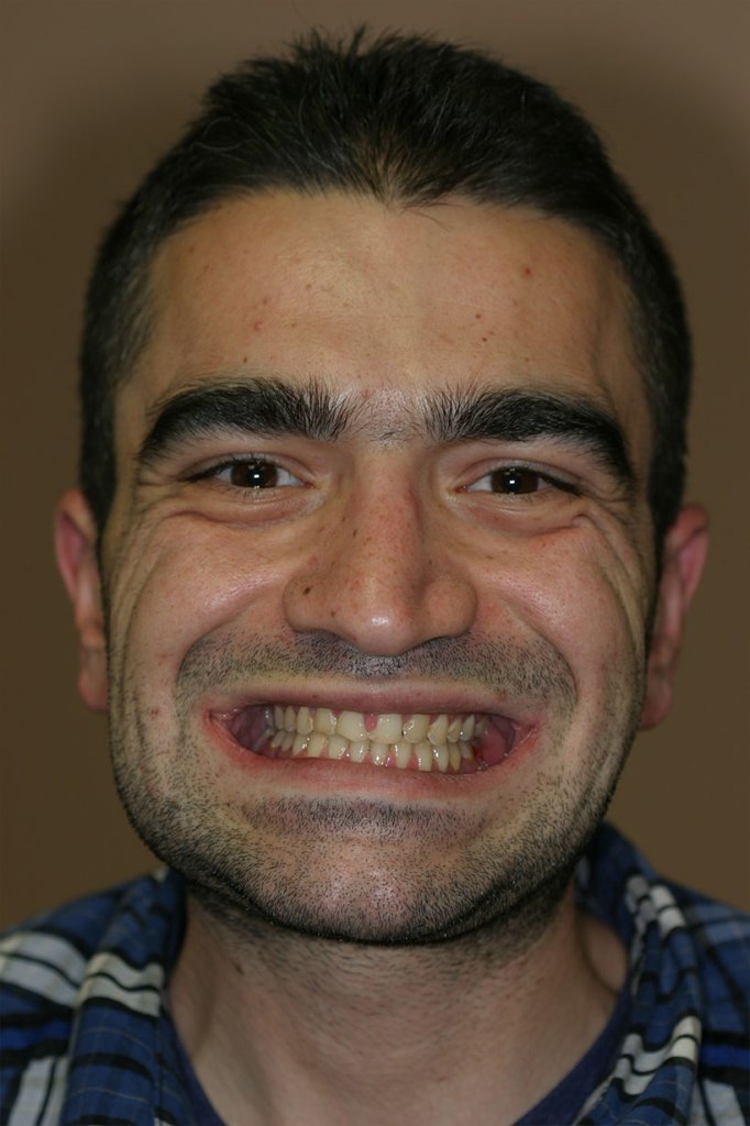 smile gallery photo