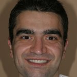 smile gallery photo