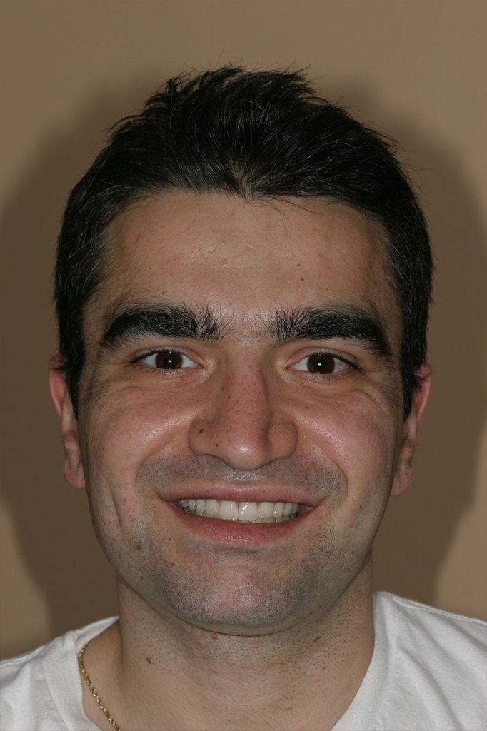 smile gallery photo