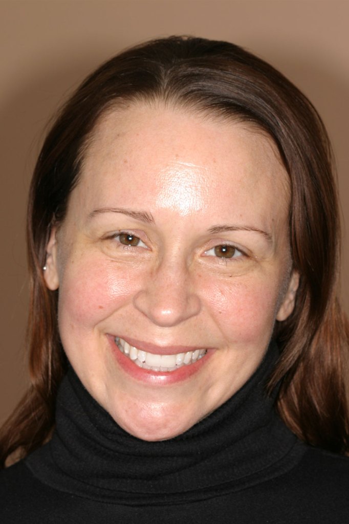 smile gallery photo