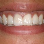 smile gallery photo